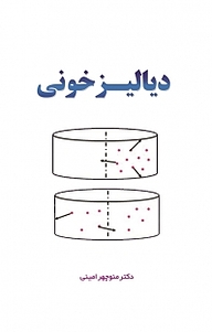 دیالیز خونی