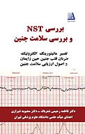 بررسی NST و بررسی سلامت جنین