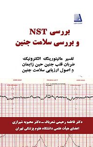 معرفی، خرید و دانلود کتاب بررسی NST و بررسی سلامت جنین