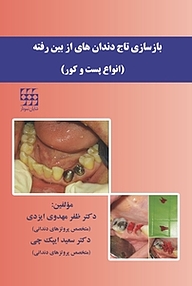 کتاب بازسازی تاج دندان های از بین رفته  انواع پست و کور نشر انتشارات شایان نمودار   