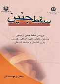 سقط جنین