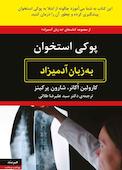 پوکی استخوان به زبان آد‌‌میزاد