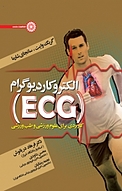 الکتروکاردیوگرام (ECG)