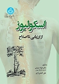 اسکولیوز