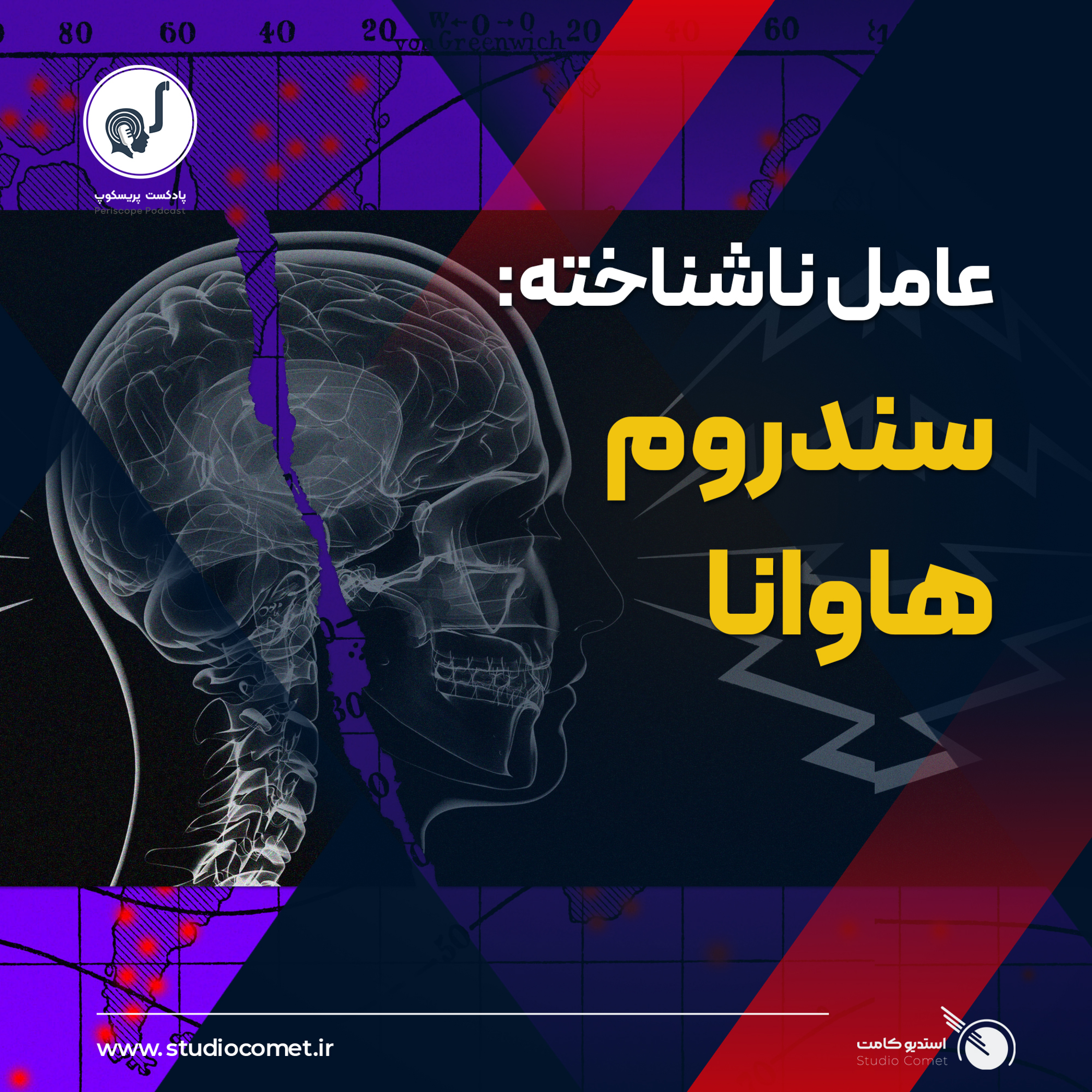 04 - سندروم هاوانا